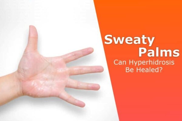 Sweaty Palms: Can Hyperhidrosis Be Healed?